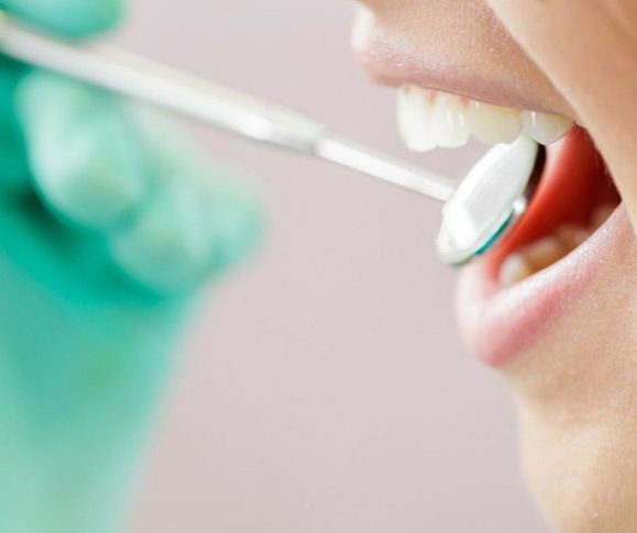 What Are Dental Implants and Why Do They Matter?