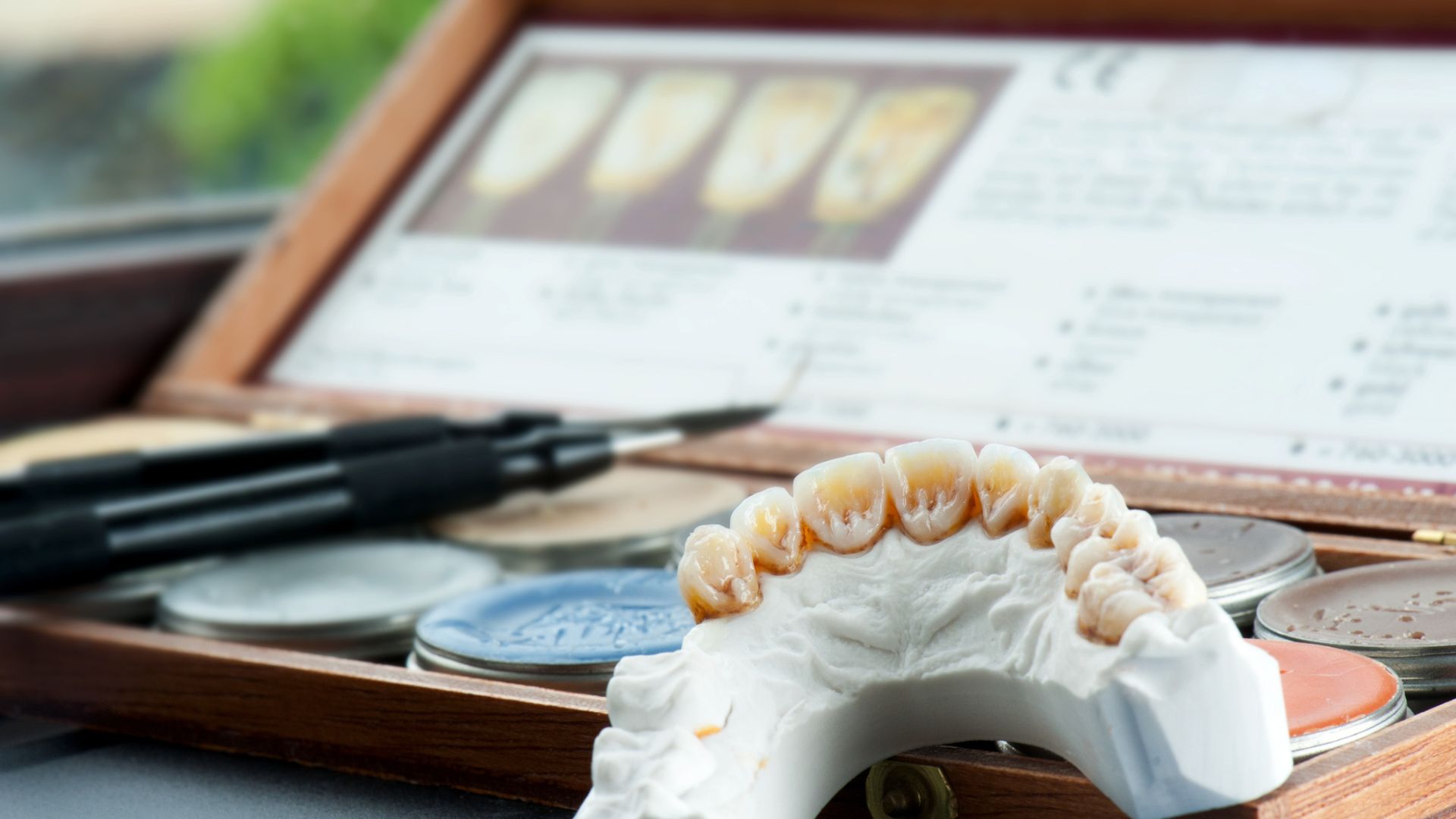 Benefits of Dental Implants